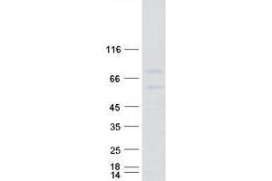 Validation with Western Blot