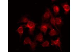ABIN6272397 staining LOVO by IF/ICC. (POLR3B anticorps  (C-Term))