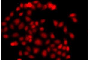 Immunofluorescence analysis of  cells using MLF1 antibody (ABIN6128237, ABIN6143874, ABIN6143876 and ABIN6217281). (MLF1 anticorps  (AA 1-268))