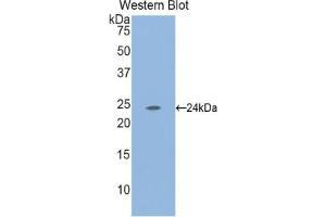 Western blot analysis of the recombinant protein. (Laminin anticorps  (AA 2901-3106))