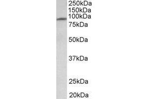 Western Blotting (WB) image for anti-Major Facilitator Superfamily Domain Containing 6 (MFSD6) (Internal Region) antibody (ABIN2465065) (MFSD6 anticorps  (Internal Region))