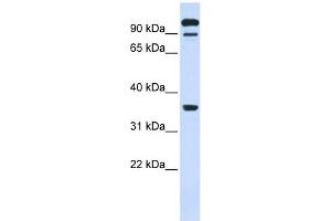 PTPRE antibody used at 1 ug/ml to detect target protein. (PTPRE anticorps  (Middle Region))