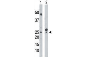 Western Blotting (WB) image for anti-Uridine-Cytidine Kinase (UCK) antibody (ABIN3003699) (UCK anticorps)