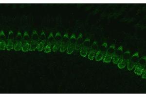 Immunostaining of cochlear inner hair cells (IHCs) from p17 C57black mouse. (Otoferlin anticorps  (Isoform 1))