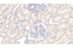 Detection of LAMP3 in Human Kidney Tissue using Polyclonal Antibody to Lysosomal Associated Membrane Protein 3 (LAMP3)