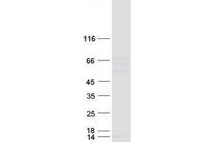 Validation with Western Blot