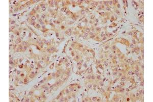 IHC image of ABIN7127540 diluted at 1:112.