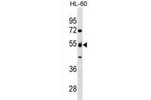 Western Blotting (WB) image for anti-Nucleosome Assembly Protein 1-Like 2 (NAP1L2) antibody (ABIN3000094) (NAP1L2 anticorps)