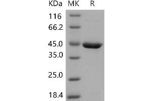 Western Blotting (WB) image for serpin Peptidase Inhibitor, Clade B (Ovalbumin), Member 10 (SERPINB10) protein (His tag) (ABIN7320212)