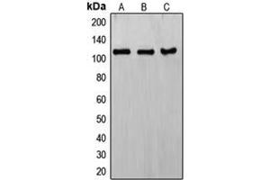 Western blot analysis of ERCC4 expression in HeLa (A), KNRK (B), MCF7 (C) whole cell lysates. (ERCC4 anticorps  (C-Term))