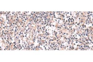 Immunohistochemistry of paraffin-embedded Human tonsil tissue using GSPT2 Polyclonal Antibody at dilution of 1:50(x200)