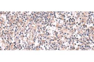 Immunohistochemistry of paraffin-embedded Human tonsil tissue using GSPT2 Polyclonal Antibody at dilution of 1:50(x200) (GSPT2 anticorps)