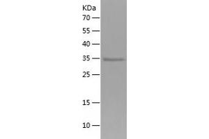 Western Blotting (WB) image for Leucine-Rich Repeat-Containing G Protein-Coupled Receptor 6 (LGR6) (AA 833-967) protein (His-IF2DI Tag) (ABIN7123755)