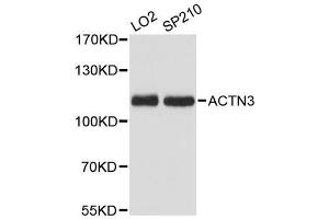 Western blot analysis of extracts of various cell lines, using ACTN3 antibody.