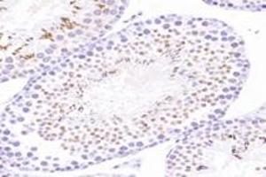 Immunohistochemistry analysis of paraffin-embedded mouse testis using,ACRBP (ABIN7072890) at dilution of 1: 8000 (ACRBP anticorps)