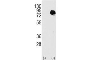 Western blot analysis of TG2 antibody and 293 cell lysate (2 ug/lane) either nontransfected or transiently transfected with the TGM2 gene.