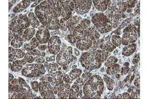 Image no. 8 for anti-NADH Dehydrogenase (Ubiquinone) 1 beta Subcomplex, 10, 22kDa (NDUFB10) antibody (ABIN1499668)