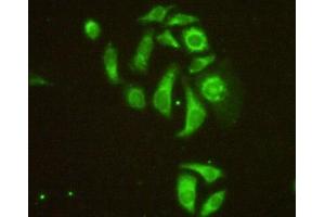 IHC-P analysis of HeLa cells, with FITC staining. (MAP4 anticorps  (AA 2-250))
