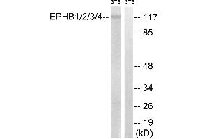 Western blot analysis of extracts from 3T3 cells, treated with heat shock, using EPHB1/2/3/4 (Ab-600/602/614/596) antibody. (EPH Receptor B1/2/3/4 (Tyr600) anticorps)