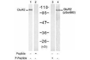 Image no. 1 for anti-Glutamate Receptor, Ionotropic, AMPA 2 (GRIA2) (pSer880) antibody (ABIN197063) (GRIA2 anticorps  (pSer880))