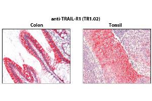 Immunohistochemistry detection of endogenous TRAIL-R1 in paraffin-embedded human carcinoma tissues (colon, tonsil) using mAb to TRAIL-R1 (TR1. (TNFRSF10A anticorps)