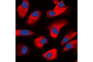 Immunofluorescent analysis of PKC zeta staining in HeLa cells.