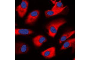 Immunofluorescent analysis of PKC zeta staining in HeLa cells.