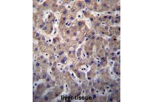 SULT1A3/SULT1A4 Antibody (N-term) immunohistochemistry analysis in formalin fixed and paraffin embedded human liver tissue followed by peroxidase conjugation of the secondary antibody and DAB staining.