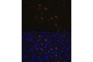 Immunofluorescence analysis of mouse brain using GFAP Rabbit mAb (ABIN7267389) at dilution of 1:100 (40x lens).