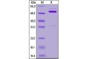 Human NRG1 Beta 1, Fc Tag on  under reducing (R) condition. (NRG1-beta 1 Protein (AA 2-246) (Fc Tag))