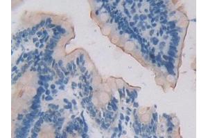 Detection of 15-LO-2 in Rat Small intestine Tissue using Polyclonal Antibody to 15-Lipoxygenase-2 (15-LO-2) (ALOX15B anticorps  (AA 349-633))