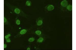 Anti-A1AT mouse monoclonal antibody (ABIN2452352) immunofluorescent staining of HeLa cells transiently transfected by pCMV6-ENTRY SERPINA1 (RC202082) (SERPINA1 anticorps  (AA 26-418))