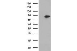 Western Blotting (WB) image for anti-Epoxide Hydrolase 2, Cytoplasmic (EPHX2) antibody (ABIN1500856) (EPHX2 anticorps)