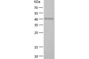 Western Blotting (WB) image for SH3-Domain GRB2-Like Endophilin B2 (SH3GLB2) (AA 1-395) protein (His tag) (ABIN7125083)