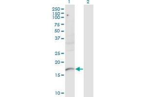 Western Blot analysis of PLXNA2 expression in transfected 293T cell line by PLXNA2 monoclonal antibody (M06), clone 2G5.