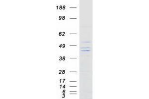 Validation with Western Blot