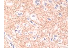 DAB staining on IHC-P; Samples: Human Cerebrum Tissue (Desmocollin 1 anticorps  (AA 486-686))