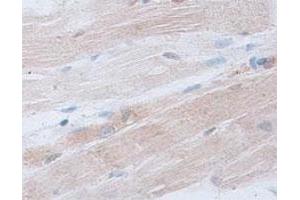 Immunohistochemical staining of formalin-fixed paraffin-embedded human skeletal muscle tissue showing cytoplasmic staining with ACTRT2 polyclonal antibody  at 1 : 100 dilution.