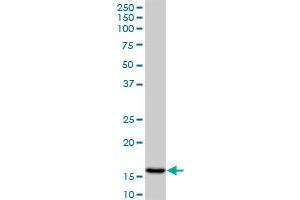 AGR2 monoclonal antibody (M01A), clone 1E5. (AGR2 anticorps  (AA 1-175))