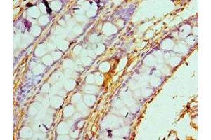 Immunohistochemistry of paraffin-embedded human colon tissue using ABIN7146462 at dilution of 1:100