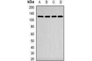 Western blot analysis of SMARCAD1 expression in A549 (A), HepG2 (B), mouse kidney (C), mouse lung (D) whole cell lysates. (SMARCAD1 anticorps)