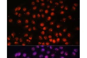 Immunofluorescence analysis of HeLa cells using TFEB Polyclonal Antibody at dilution of 1:100. (TFEB anticorps)