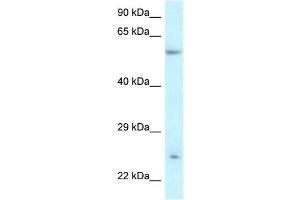 WB Suggested Anti-DERL3 Antibody Titration:  0.