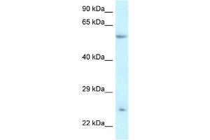 WB Suggested Anti-DERL3 Antibody Titration:  0. (Derlin-3 anticorps  (Middle Region))