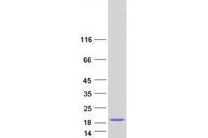 KH Homology Domain Containing 1-Like (KHDC1L) protein (Myc-DYKDDDDK Tag)