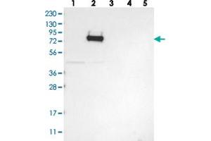 Western blot analysis of Lane 1: RT-4, Lane 2: U-251 MG, Lane 3: Human Plasma, Lane 4: Liver, Lane 5: Tonsil with GLT25D2 polyclonal antibody . (GLT25D2 anticorps)