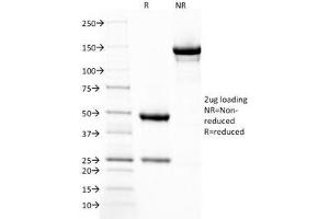 SDS-PAGE Analysis of Purified, BSA-Free Thrombomodulin Antibody (clone THBD/1782).