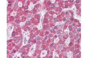 Anti-ABCC5 / MRP5 antibody IHC of human liver. (ABCC5 anticorps  (AA 2-13))