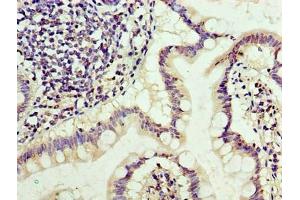 Immunohistochemistry of paraffin-embedded human small intestine tissue using ABIN7171285 at dilution of 1:100 (TRBC1 anticorps  (AA 1-176))