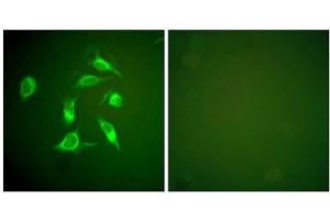 Immunofluorescence analysis of HeLa cells, using PDGFR alpha antibody. (PDGFRA anticorps  (C-Term))